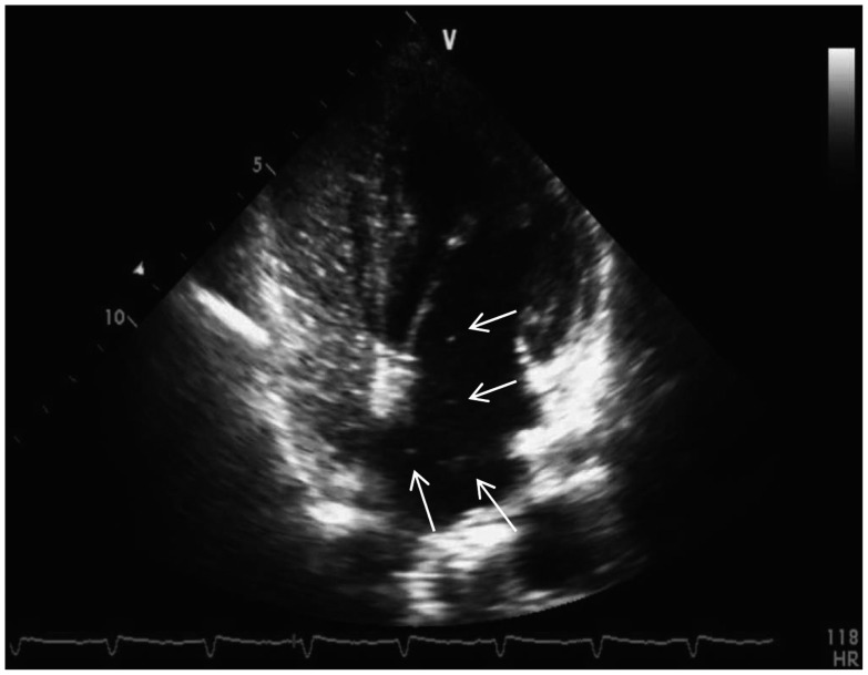 Fig. 4