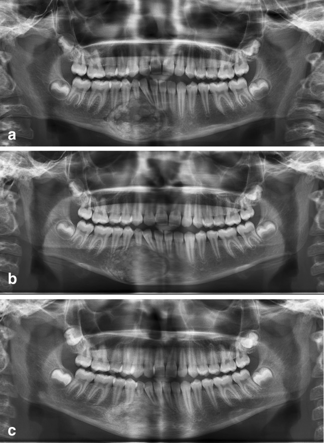 Fig. 6