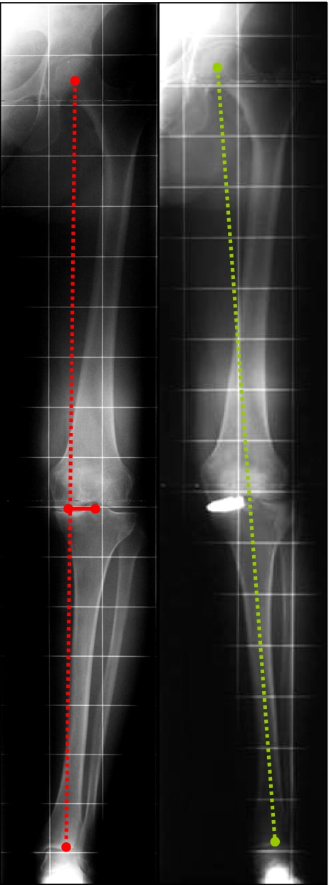 Fig. 4