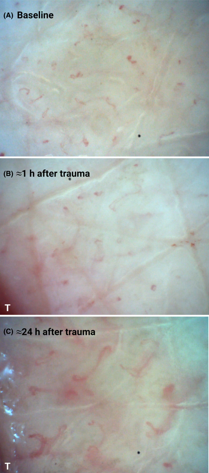 FIGURE 1