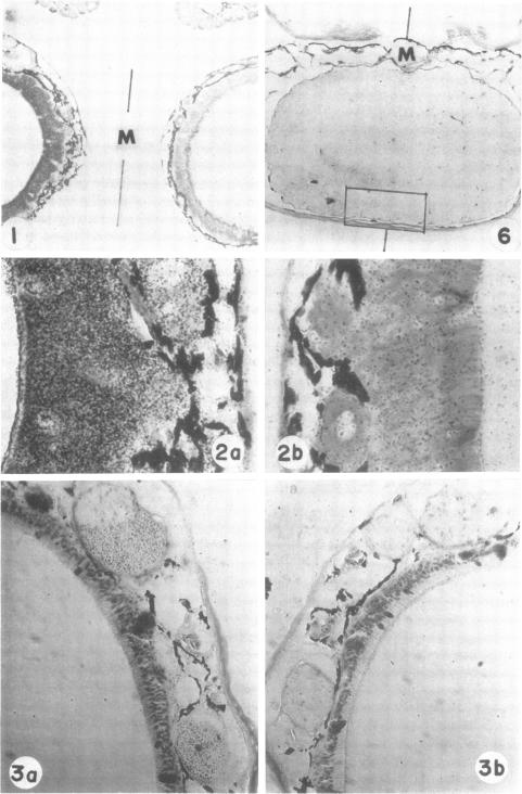 graphic file with name pnas00675-0076-a.jpg