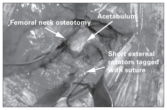 Fig. 12