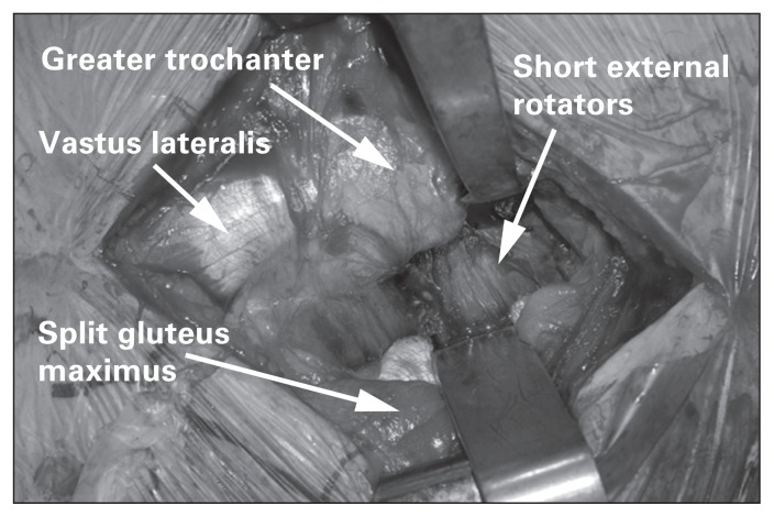 Fig. 11