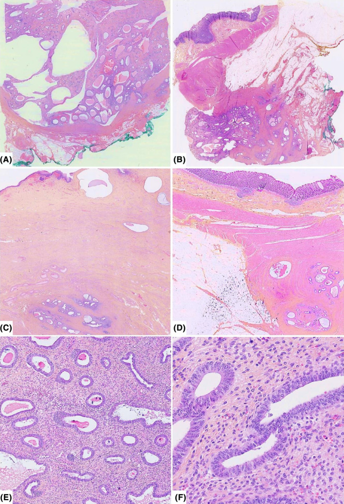 FIGURE 3