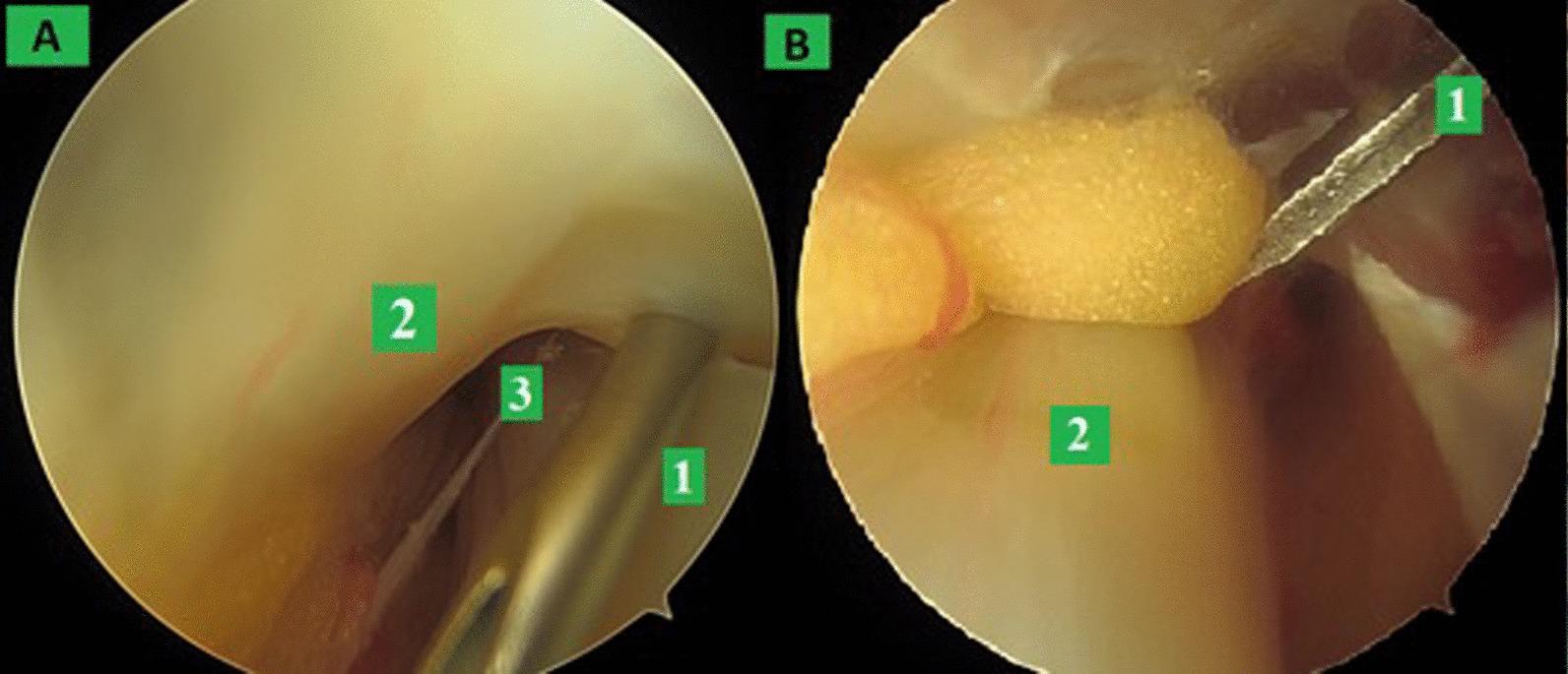 Fig. 2