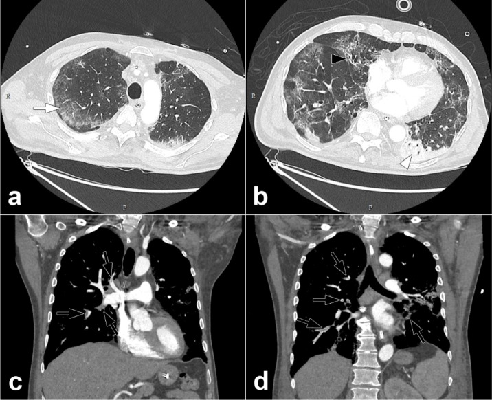 Figure 2: