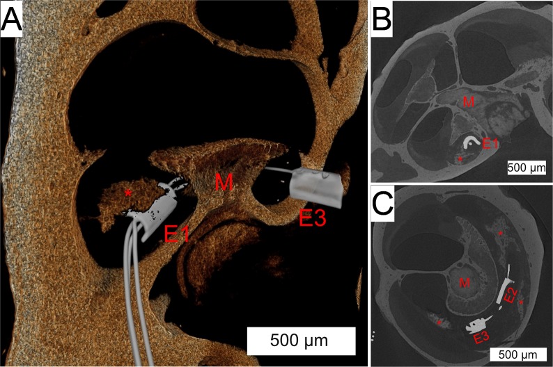 Fig 11