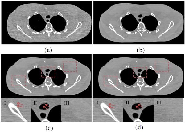 Fig. 11