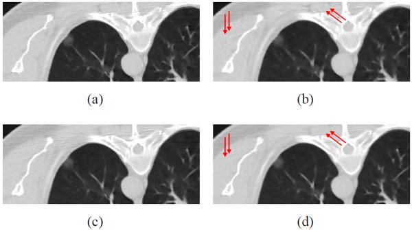 Fig. 14