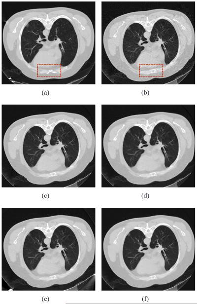 Fig. 13