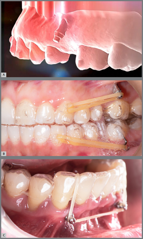 Figure 2: