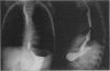 85