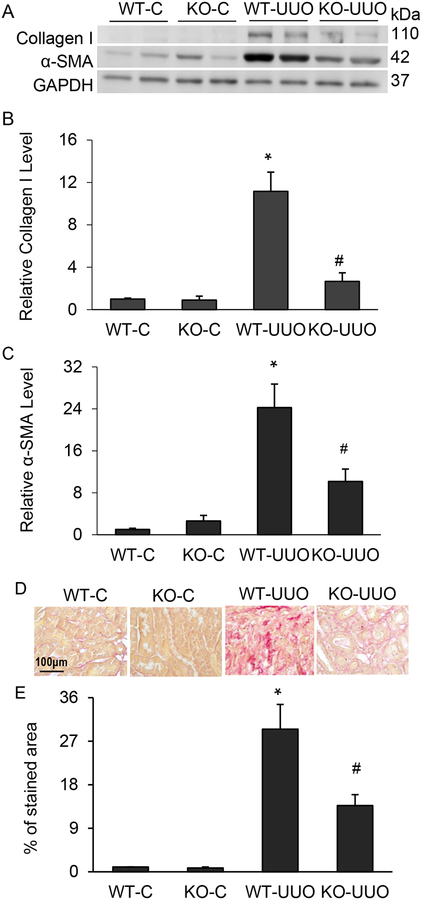 Knockout Of Sphingosine Kinase 1 Attenuates Renal Fibrosis In 