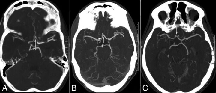 Fig 1.