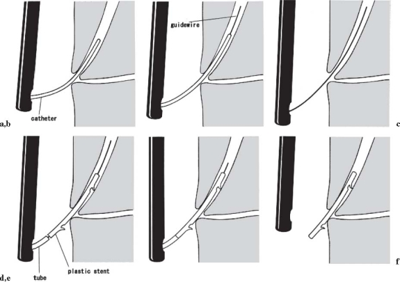 Fig. 11a–f