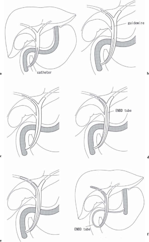 Fig. 9a-f