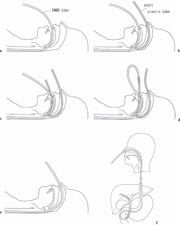 Fig. 10a–f