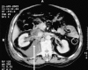 Fig 2b