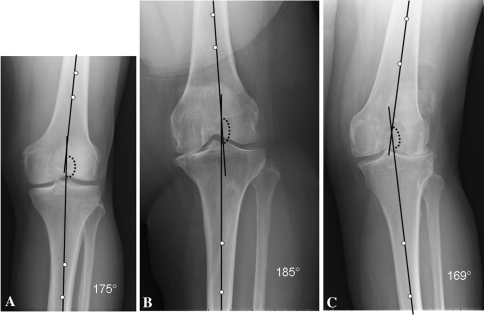 Fig. 1A–C