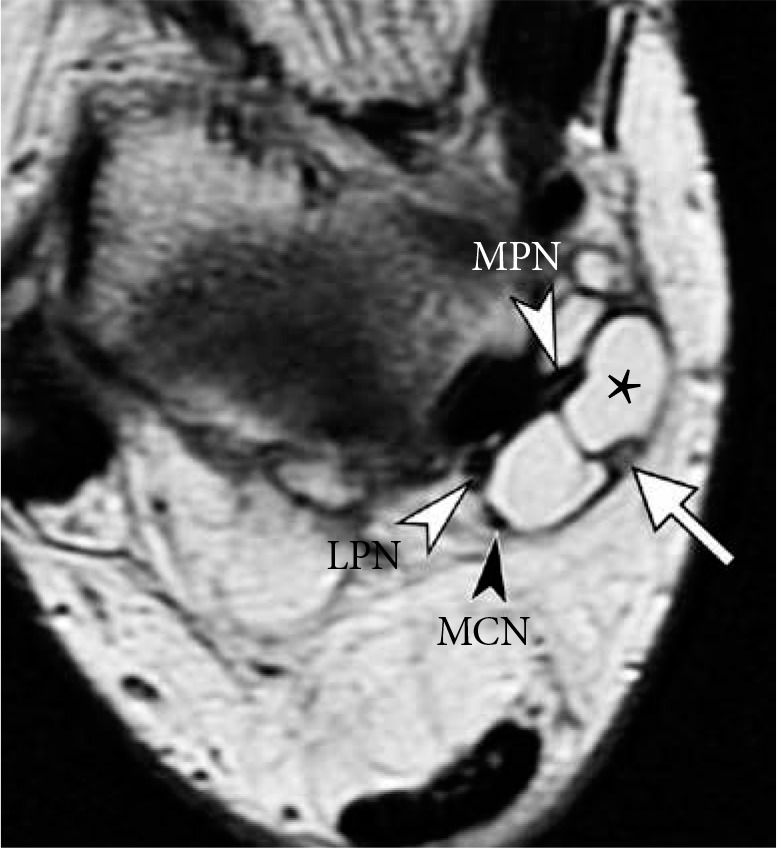 Figure 20