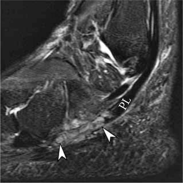 Figure 17