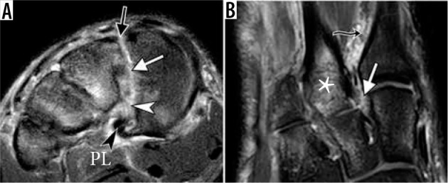 Figure 23