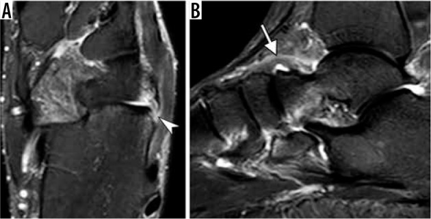 Figure 21