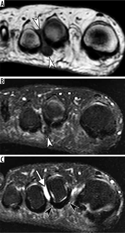 Figure 25