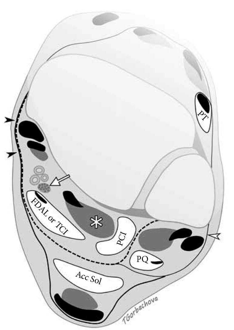 Figure 18