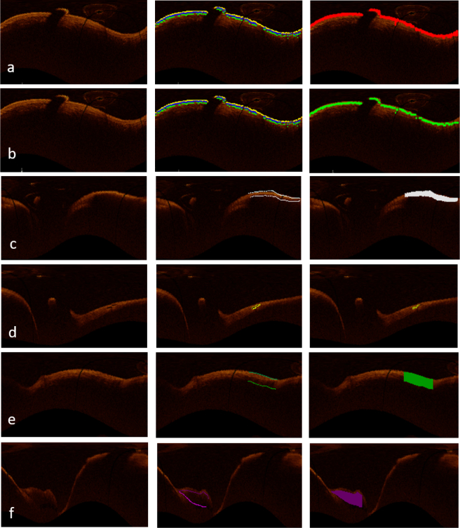 Fig. 17