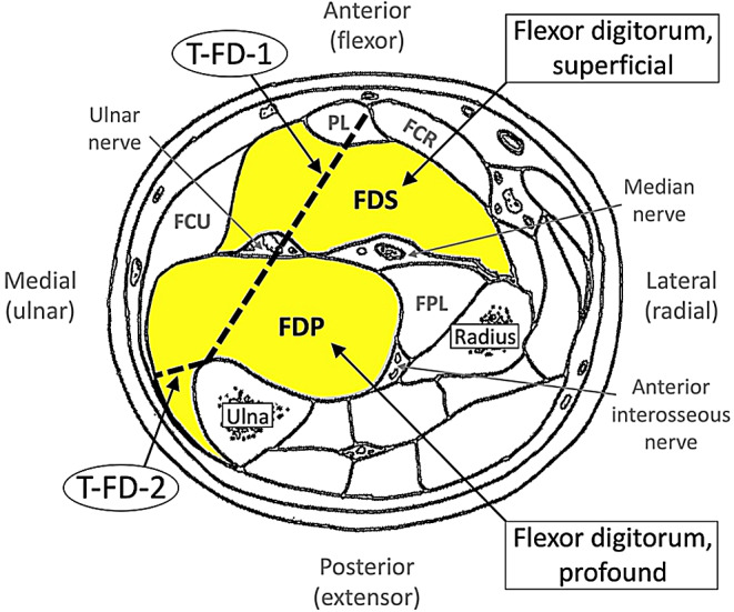 Fig. 1