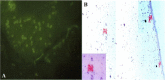 Fig. 2: