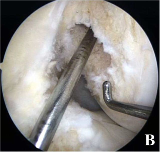 Fig. 10-B