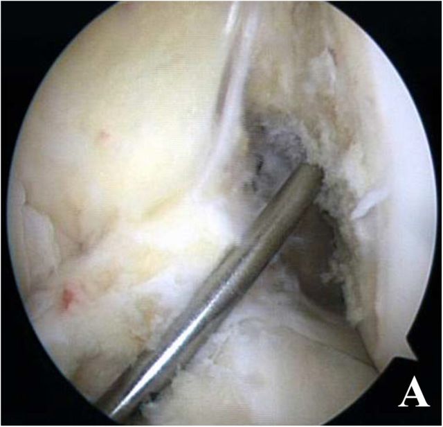 Fig. 10-A