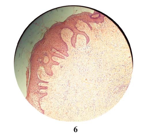 [Table/Fig-6]: