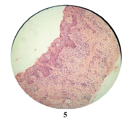 [Table/Fig-5]: