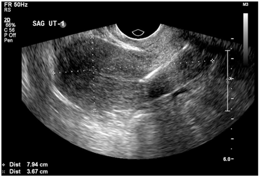 Figure 1: