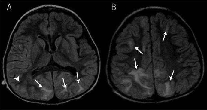 Figure 3A & B: