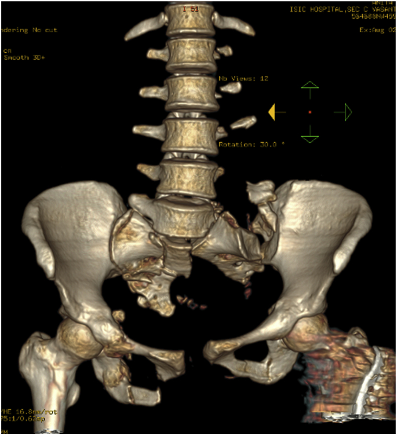 Fig. 11