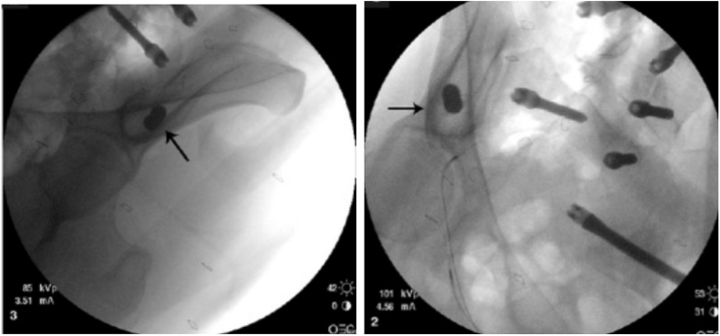 Fig. 7