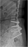 Fig. 16