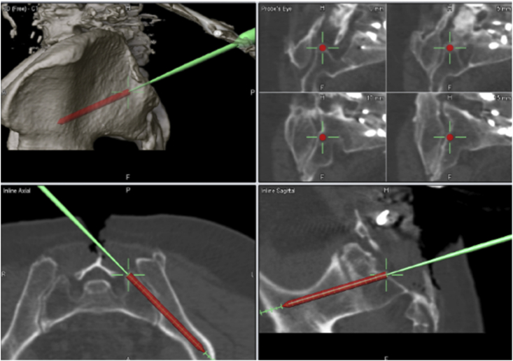 Fig. 10