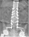 Fig. 13
