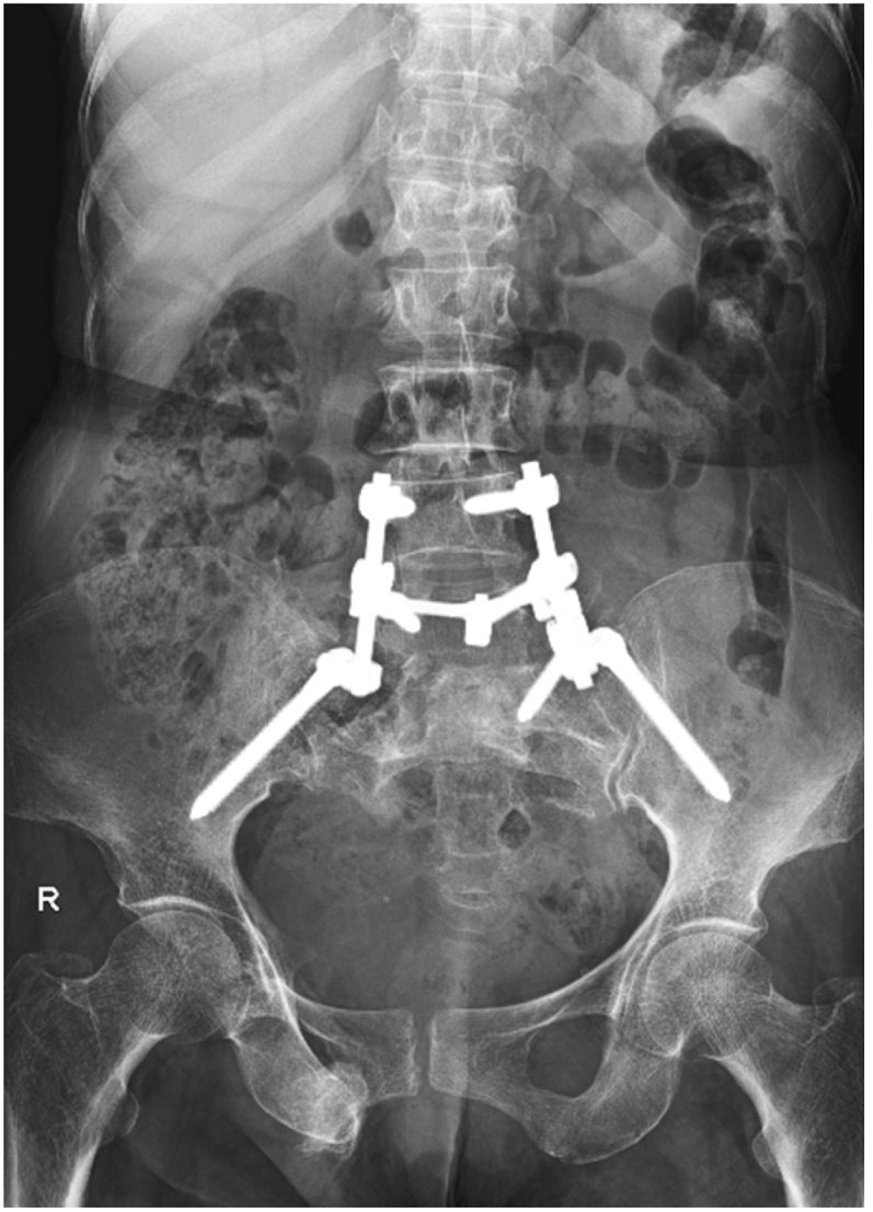 Fig. 2