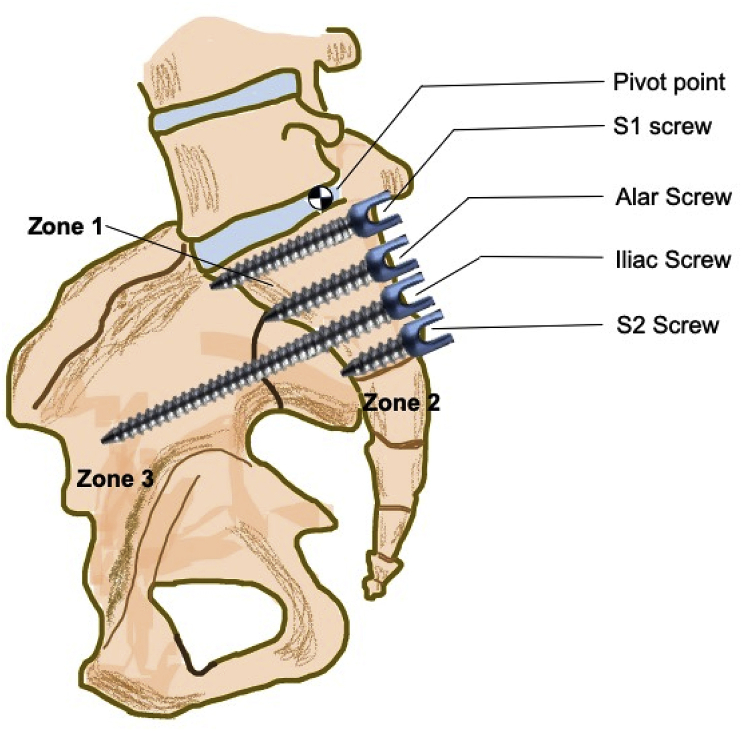 Fig. 1