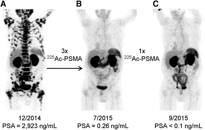 FIG. 4.