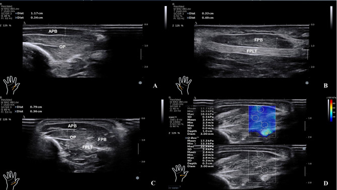 Fig. 2