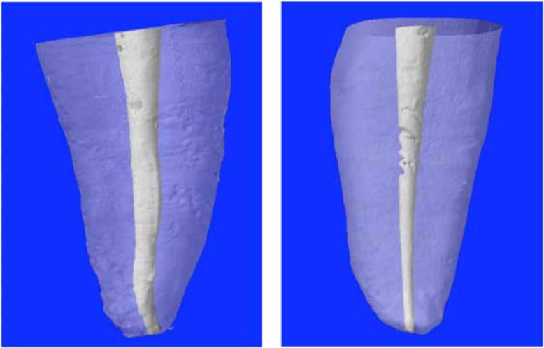 Fig. (1)