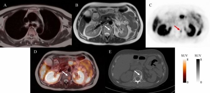 Fig. 2