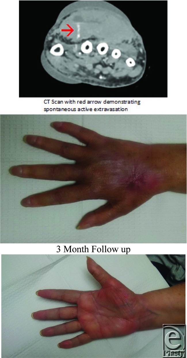 graphic file with name eplasty15ic44_fig2.jpg